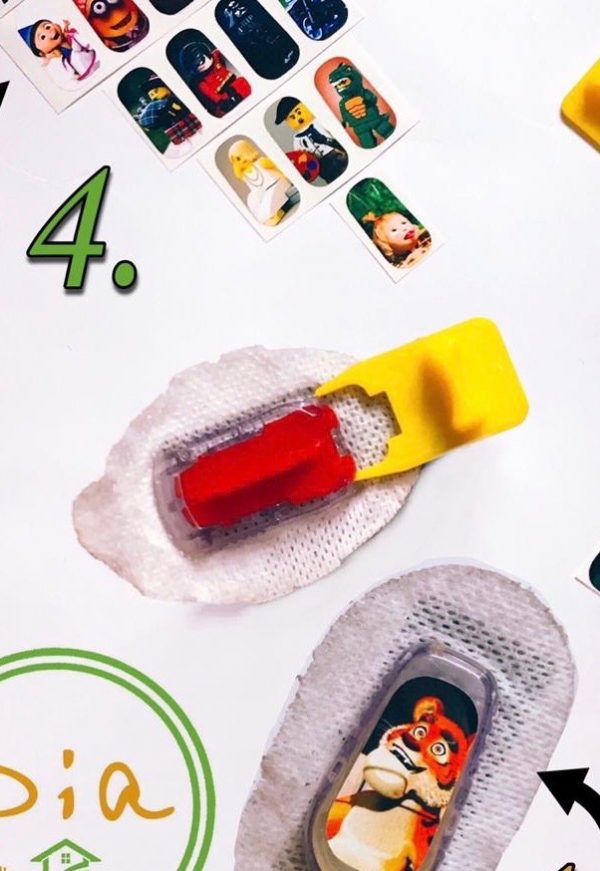 Экстрактор для трансмиттера Dexcom G5 - Image 2